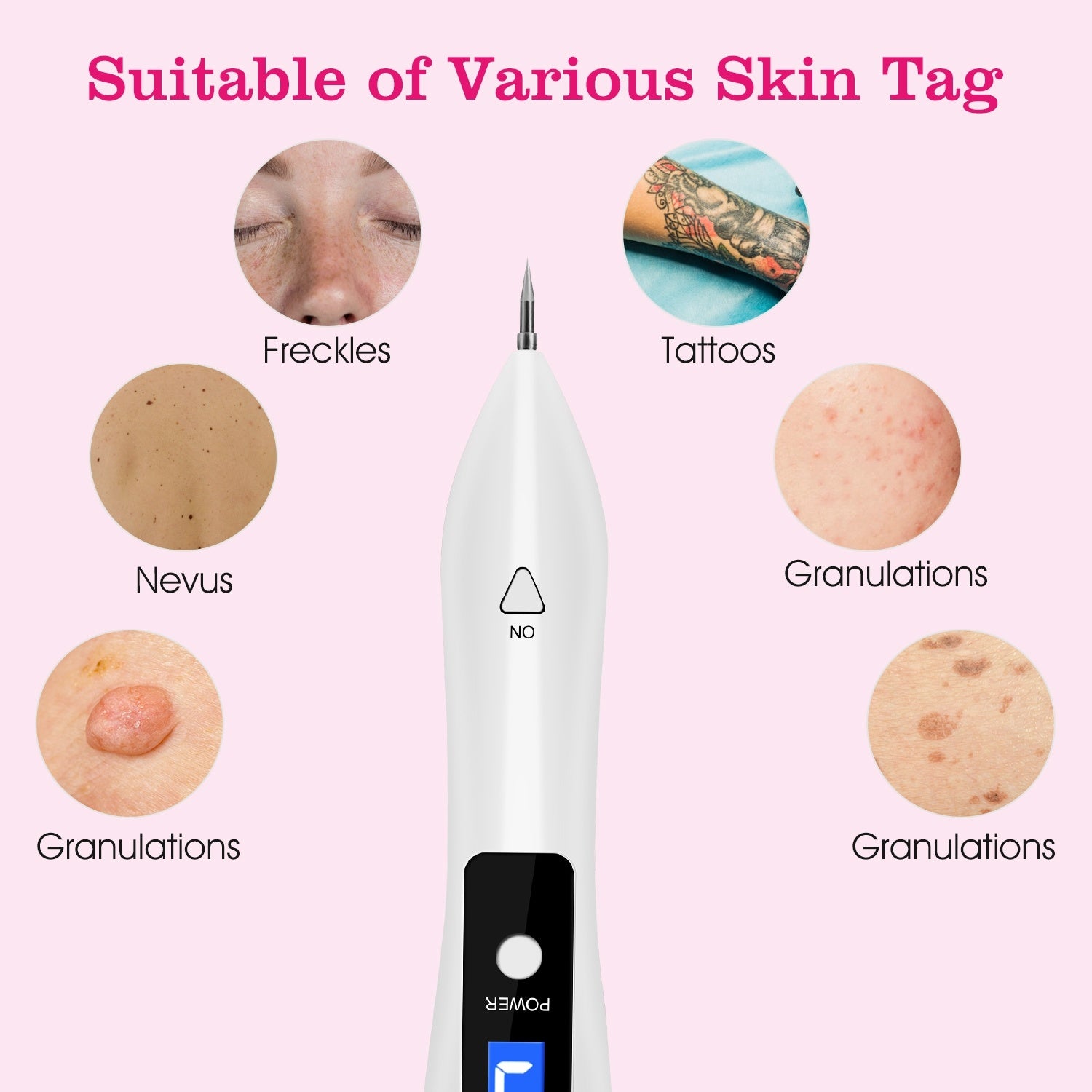 Portable Skin Tag Repair Kit. Portable Home Beauty Equipment Multi-Level