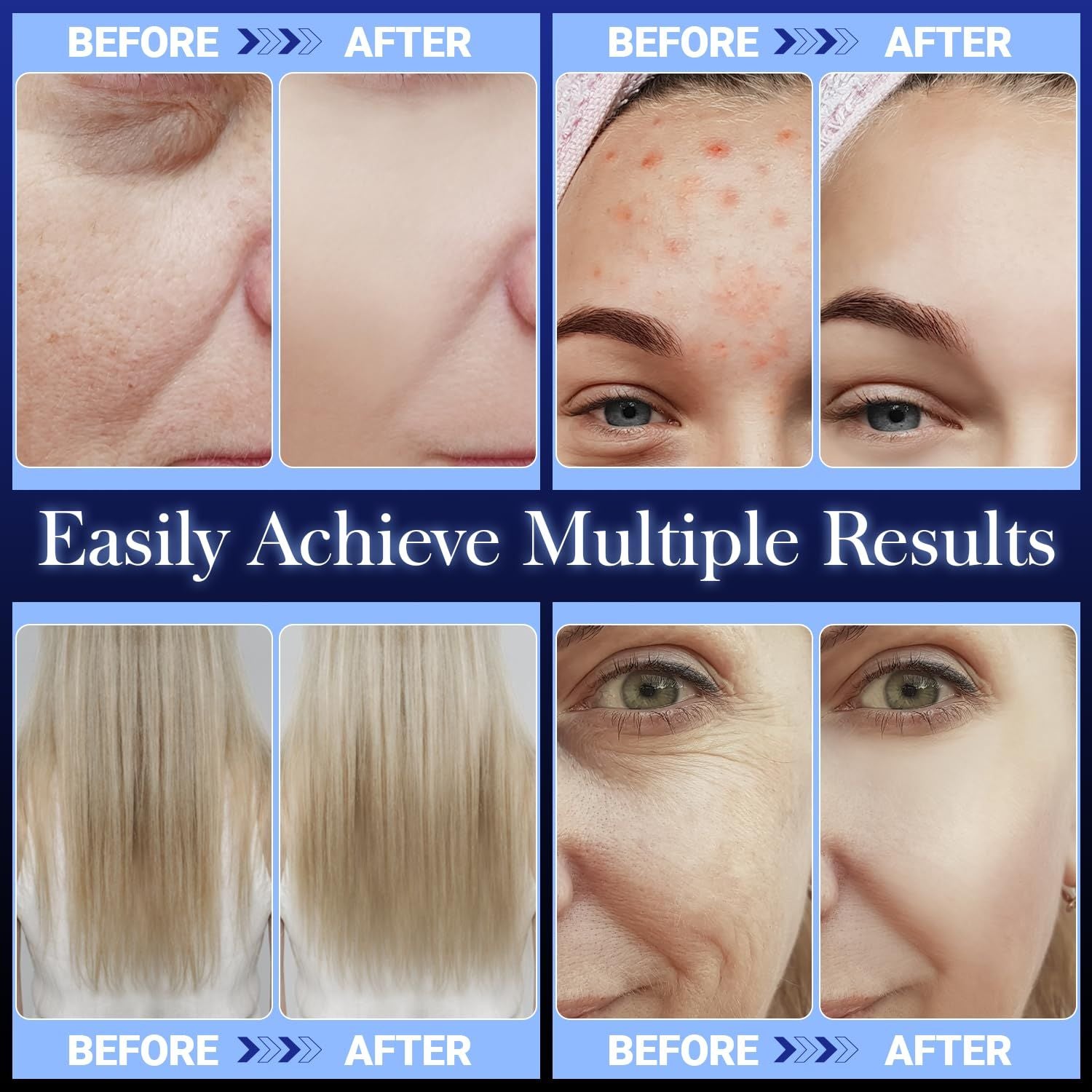 High Frequency Wand 'C Violet Portable Skin Therapy Machine
