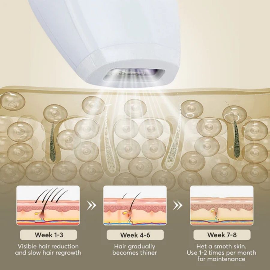Professional Laser Epilator - IPL Body Hair Removal
